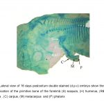 Prenatal Ossification